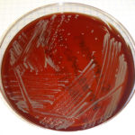 nontuberculous mycobacterial (NTM) in Your Showerhead
